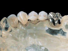 Laboratorio Dental JC Protesis Dental